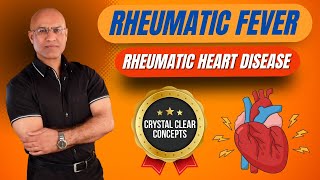 Rheumatic Fever Pathophysiology  Rheumatic Heart Disease [upl. by Rodrigo894]