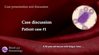 Patient case discussion case 1 [upl. by Baiss615]