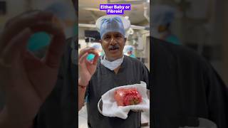 Either Baby or Fibroid  pregnant baby fibroidremoval babybirth uterus 8yearwait [upl. by Ansela849]