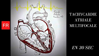 Arythmies animation cardiaque et ECG  Tachycardie Atriale Multifocale Shorts [upl. by Eiboj]