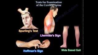 Tests For Examination Of The Cervical Spine  Everything You Need To Know  Dr Nabil Ebraheim [upl. by Vial]