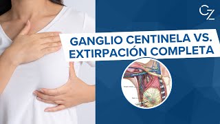 Ganglio Centinela vs Extirpación Completa [upl. by Ireva]