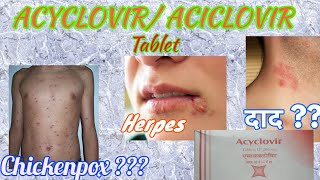 Acyclovir tablets  Herpikind  Herpikind Tablet  Zovirax  Zovirax tablets  uses side effects [upl. by Mirabel776]