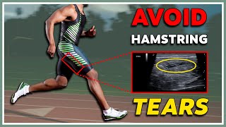 Hamstring tear  again  How to avoid and heal them [upl. by Ahtnama]