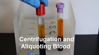 Centrifugation and Aliquoting of Blood Serum and Plasma [upl. by Clary]