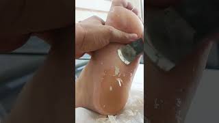 Soaked foot skin is easy to scrape off [upl. by Curley]