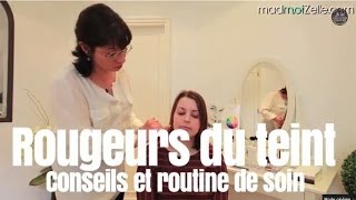 Rougeurs du teint  conseils et routine de soin  maquillage [upl. by Wilfrid490]