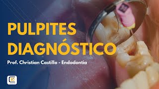 ENDODONTIA 4  INSTITUTO MAIS [upl. by Lamonica]