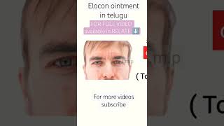 elocon ointment review in telugu  full video in relate button medicine fact [upl. by Nerua168]