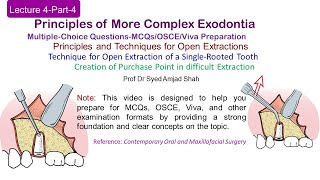 Lecture 4 Part4 MCQs  Open Extraction of Single Rooted Tooth  OSCE  VIVA [upl. by Laine]