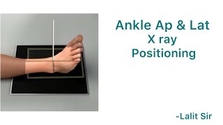 Ankle x ray positioning [upl. by Redmond]