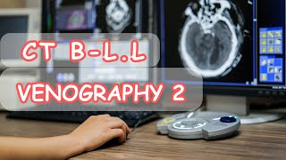 Ct venography reconstructionتقطيع واعادة بناء صور أوردة الطرفين السفليين [upl. by Welcher]