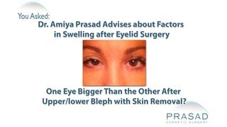 Factors in the Healing Process that Cause Temporary Swelling after Eyelid Surgery [upl. by Asemaj969]