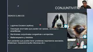 Conjuntivitis [upl. by Snyder]