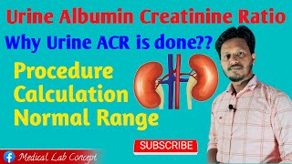 Urine ACR Principle amp Procedure with Calculation Labology [upl. by Tifanie77]