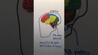 Le ASSURDE TEORIE di CESARE LOMBROSO 🧠 lombroso criminale teoria frenologia imparaconyoutube [upl. by Anallij]