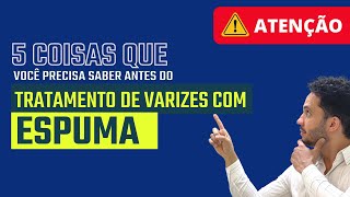 5 coisas que você precisa saber antes de tratar as varizes com espuma varizes espuma [upl. by Fernyak971]