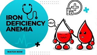 Iron deficiency anemiairon deficiency anemia treatmentanemia notesiron deficiency anemia symptoms [upl. by Tezzil]