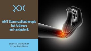 AMT Stammzellentherapie bei Arthrose im Handgelenk  ROC Aschheim [upl. by Othella1]