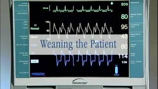 Datascope CS100 Tutorial [upl. by Nref]