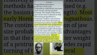 Prognathism prognathism prognathic ulotrichi African Bantu [upl. by Lelah]