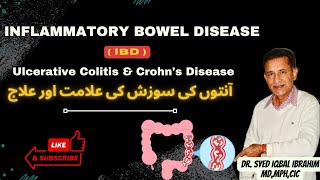 Inflammatory Bowel Disease IBD Ulcerative Colitis amp Crohn’s Disease [upl. by Arlen421]