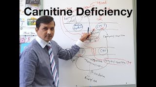 Carnitine Deficiency  Primary Carnitine Deficiency CPT I and CPT II deficiency [upl. by Ahsetal935]