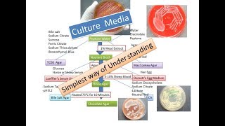 Culture media  The simplest way of understanding  for ever [upl. by Yelhak]