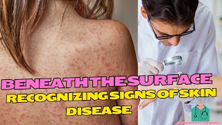 Beneath the Surface Recognizing Signs of Skin Diseases [upl. by Santana]