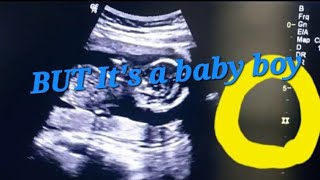 How to tell gender on ultrasound Part 2  Wrong gender reveal on ultrasound 😲  baby girl or boy usg [upl. by Emanuel599]