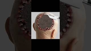 ASMR Eye Treatment Animation ASMR Maggots Aankh Extraction  ASMR 2d Animation [upl. by Irrok]