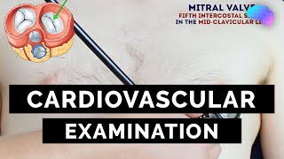 Cardiovascular Examination  OSCE Guide  UKMLA  CPSA [upl. by Nailil206]