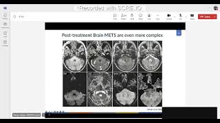 Standardized and Advanced Reporting in Brain Tumor Imaging  Mariam Aboian MDPhD [upl. by Chaddie567]