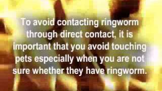 How Do You Get Ringworm [upl. by Aicital]