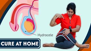 इन योग से ठीक होगा हाइड्रोसील घर बैठे  Best YOGA POSES to CURE Hydrocele at Home FAST  Yogawale [upl. by Liberati]