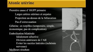 L’embolisation artérielle [upl. by Territus]