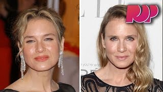 What Happened To Renee Zellweger [upl. by Ynitsed]