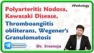 2 Polyarteritis Nodosa Kawasaki Disease Thromboangiitis obliterans Wegeners Granulomatosis [upl. by Waynant215]