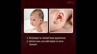 4 Effective Tips to Avoid Flat Heads in Babies [upl. by Sivartal168]