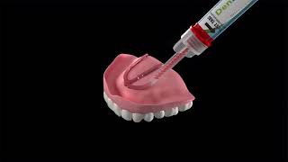 DenSureFit for Upper Denture [upl. by Woolson261]