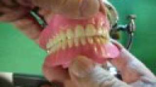 UL Dentures wax setup using a quotPrecision Coordinatorquot Ar [upl. by Anstice]