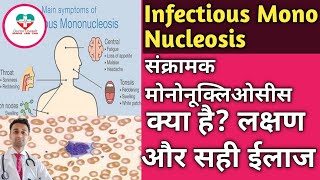 Infectious Mononucleosis MONO संक्रामक मोनो कि बीमारी क्या होती है ईलाज क्या है  पूरी जानकारी [upl. by Aliet151]