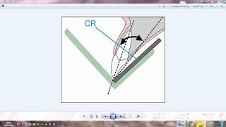 oral radiology  bisecting technique [upl. by Ahsinra129]