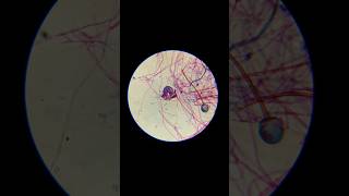 Rhizopus under the microscope [upl. by Nednyl986]