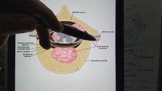 Spinal cord tumors Differences between Intra and Extramedullary lesions [upl. by Etnecniv]