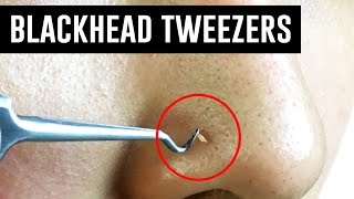 Tweezers That Remove Blackheads TINA TRIES IT [upl. by Lionello960]