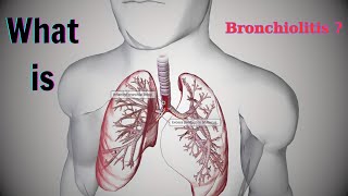 Chronic Bronchitis The Hidden Breathing Struggle Millions Face Every Day  Modern Medicine [upl. by Rydder]