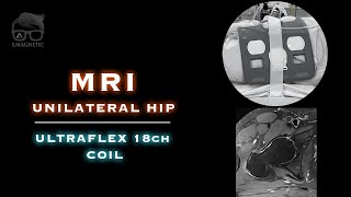 MRI – UNILATERAL HIP [upl. by Papp]