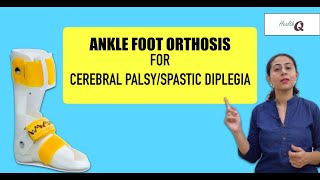 Things you should know about ANKLE FOOT ORTHOSIS [upl. by Ahsinned]