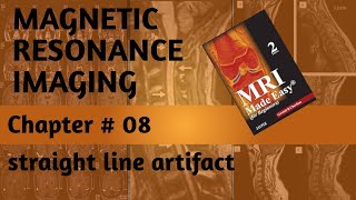 straight line artifactchapter 08MRI artifactsradiology [upl. by Bobbette976]